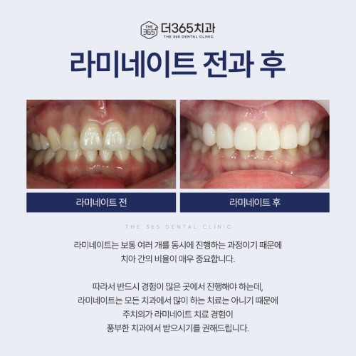 블로그 리뷰