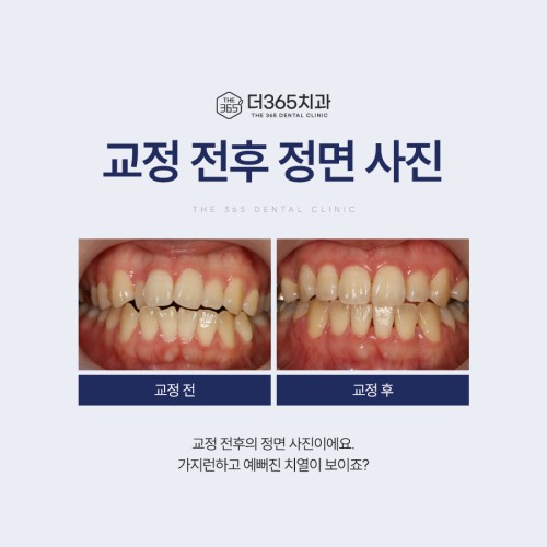 블로그 리뷰