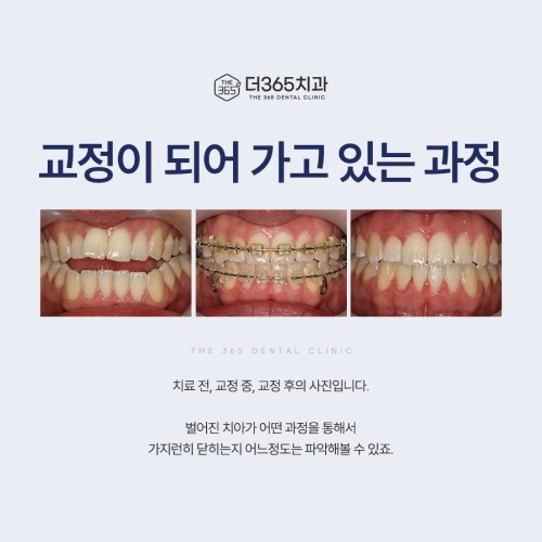 블로그 리뷰