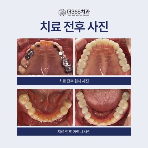 블로그 리뷰