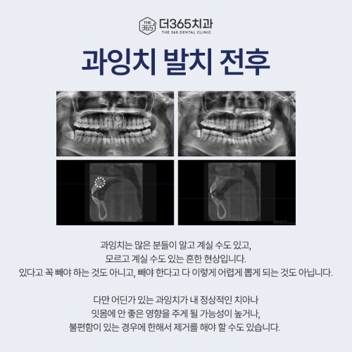 블로그 리뷰