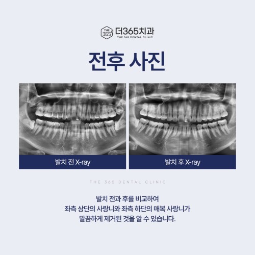 블로그 리뷰