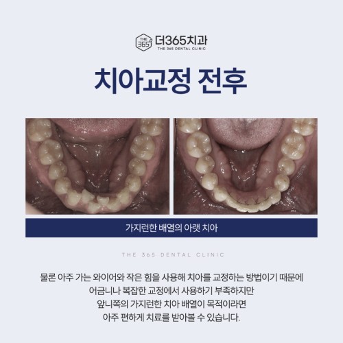 블로그 리뷰