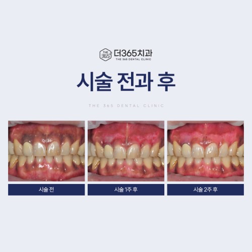 블로그 리뷰