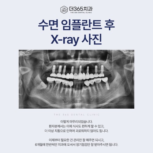 블로그 리뷰