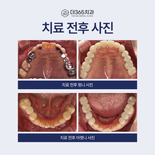 야간진료 후기 이미지