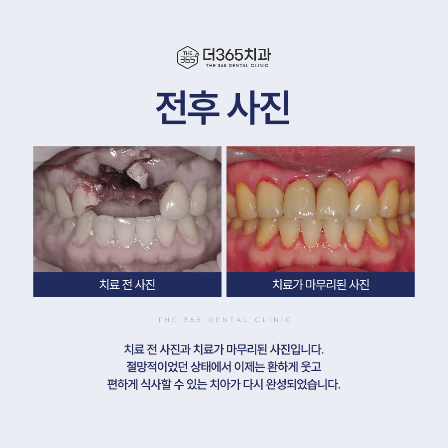 블로그 리뷰
