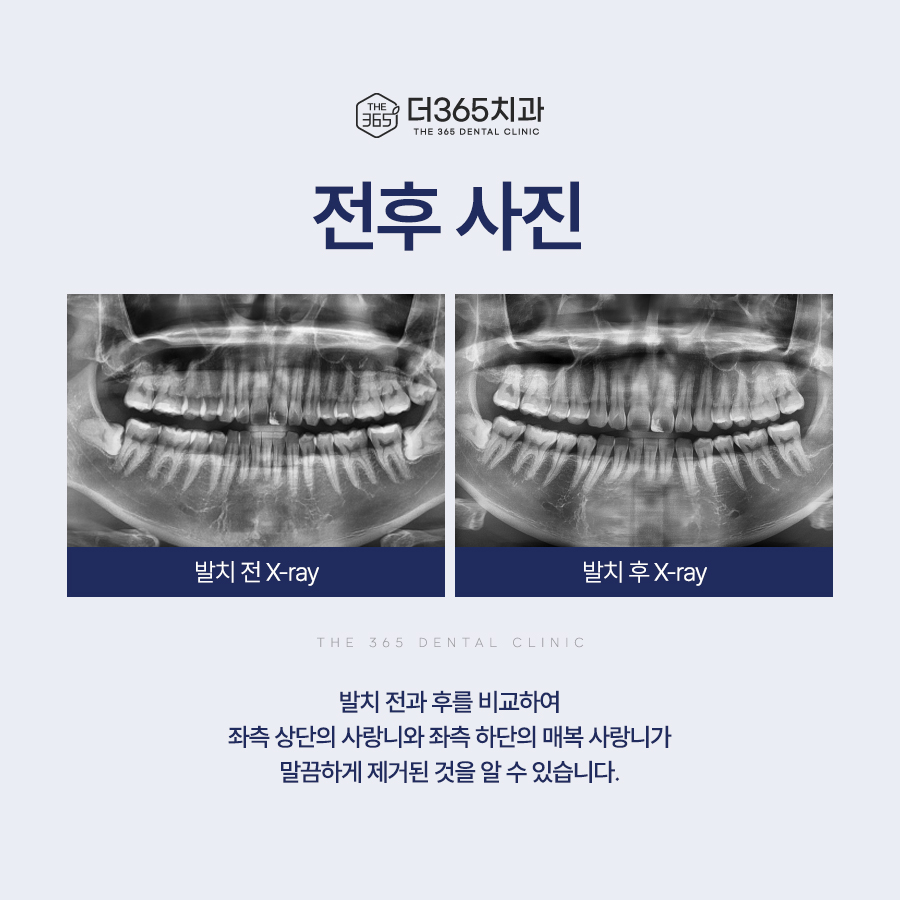블로그 리뷰