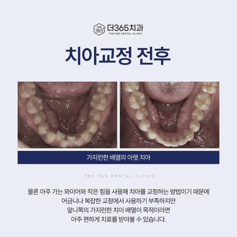 블로그 리뷰