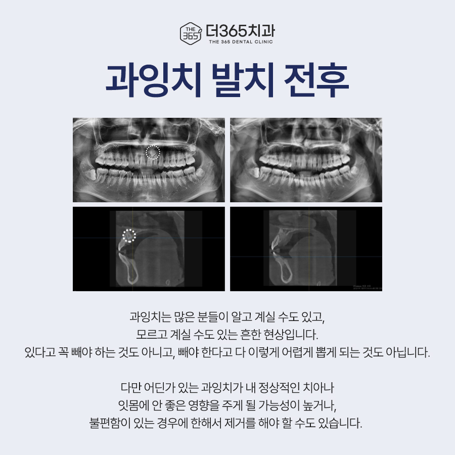블로그 리뷰