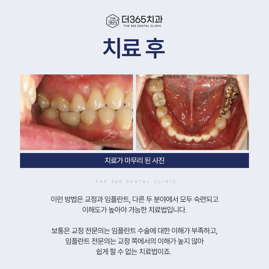 블로그 리뷰