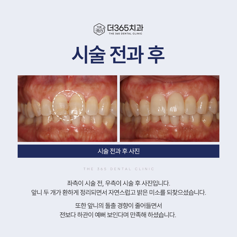 블로그 리뷰