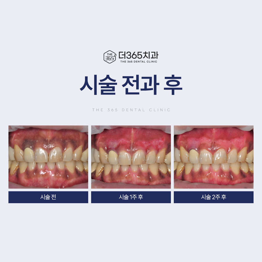 블로그 리뷰