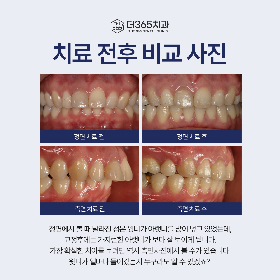 블로그 리뷰