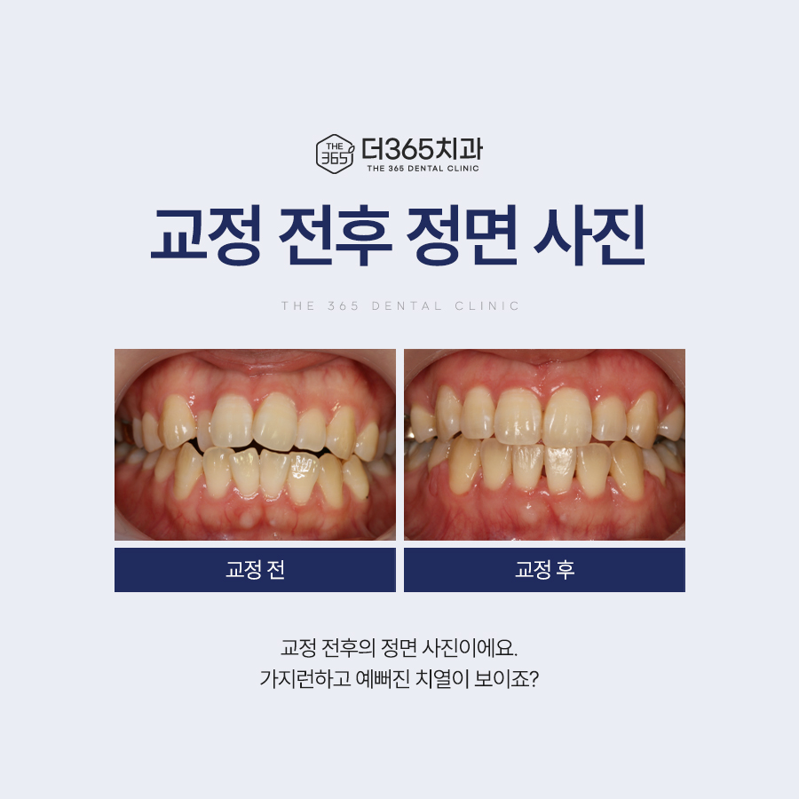 블로그 리뷰