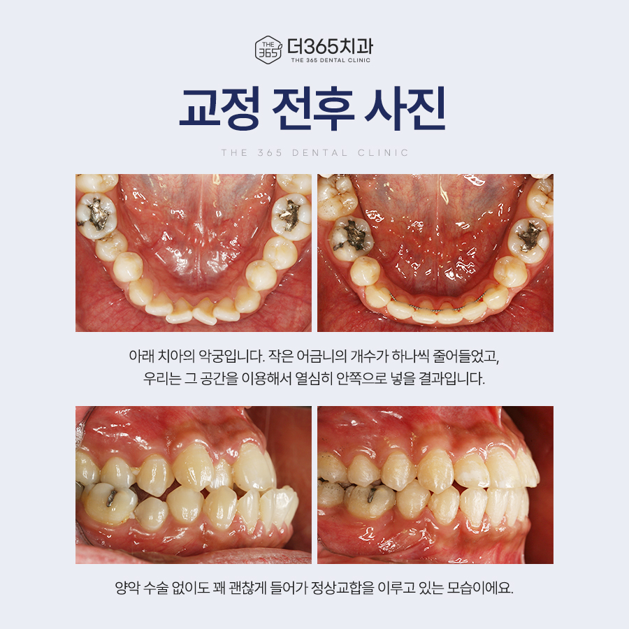 블로그 리뷰