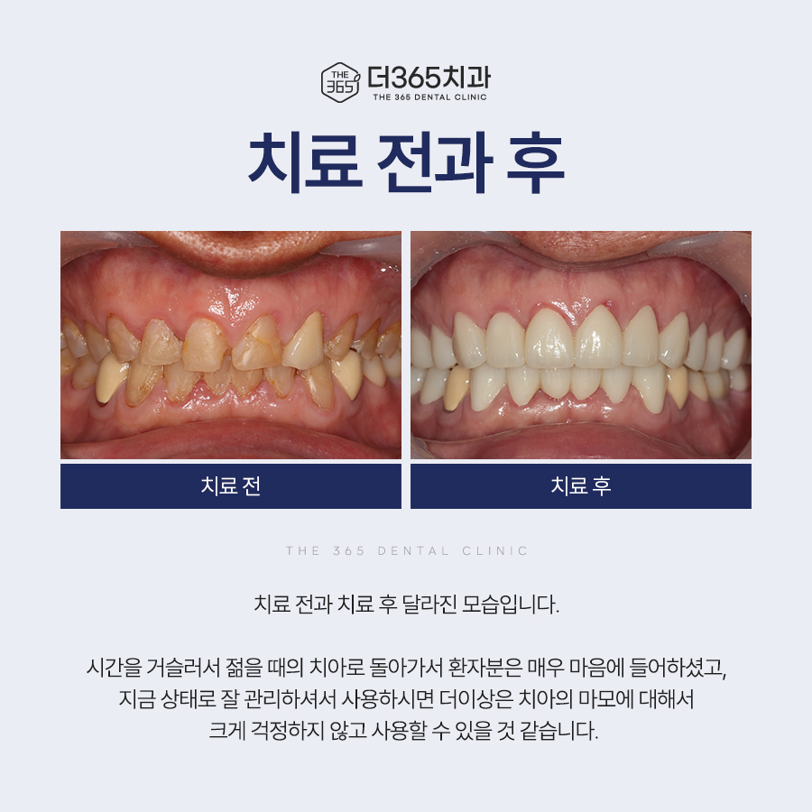 블로그 리뷰