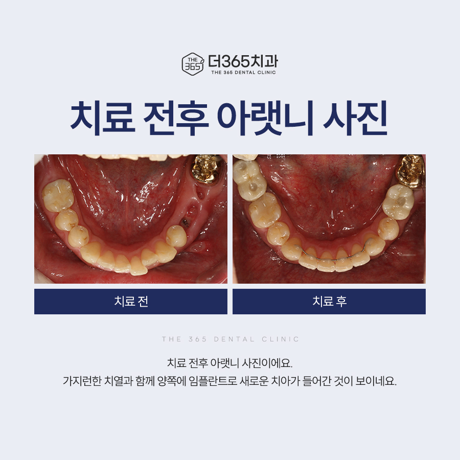 블로그 리뷰