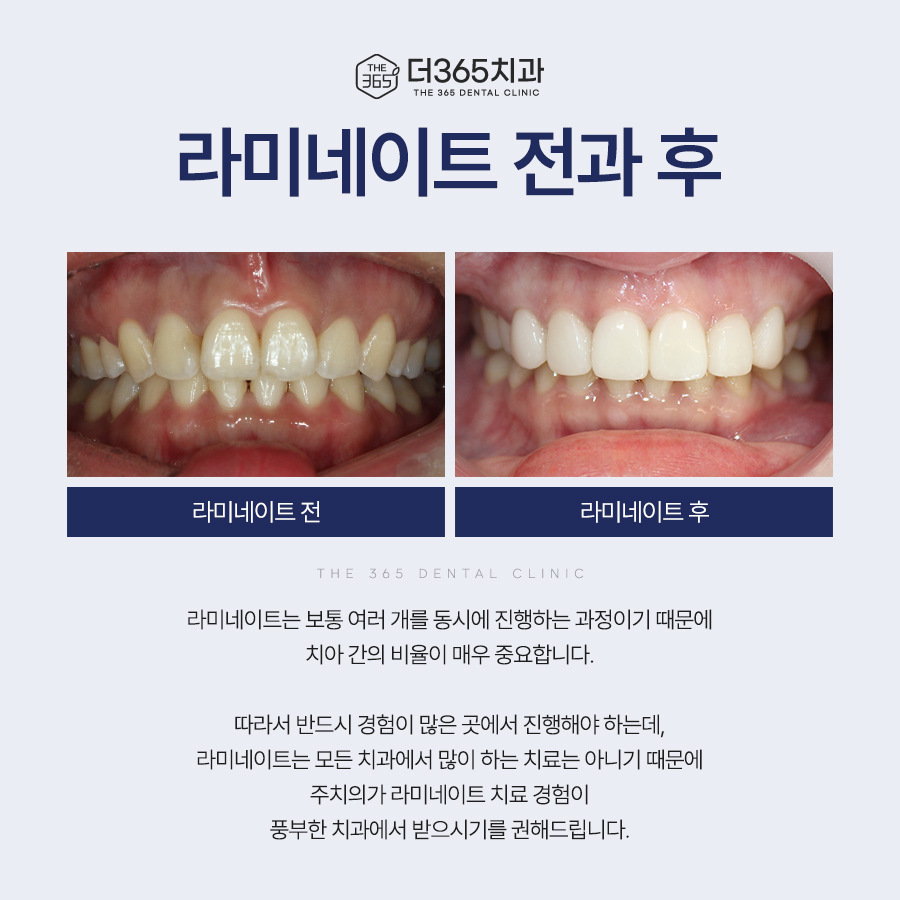 블로그 리뷰