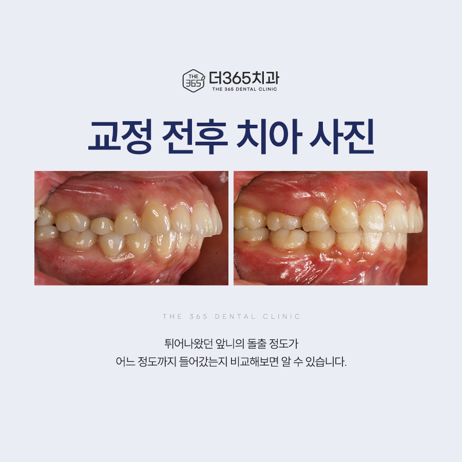 블로그 리뷰