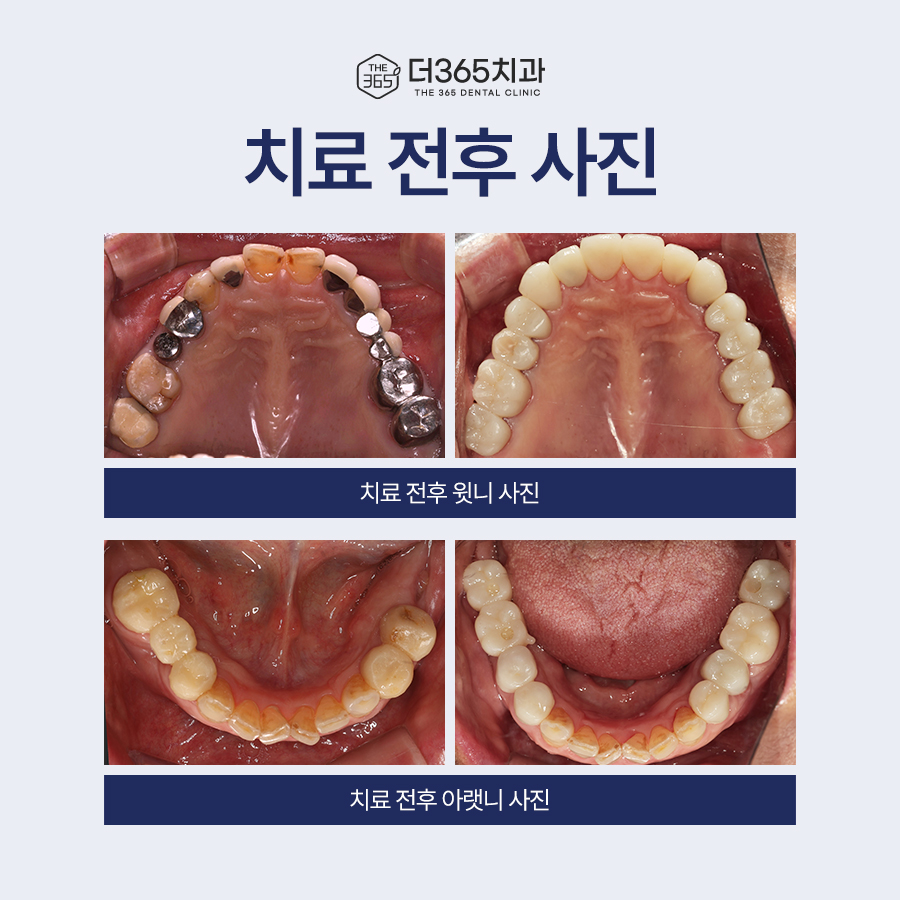 블로그 리뷰
