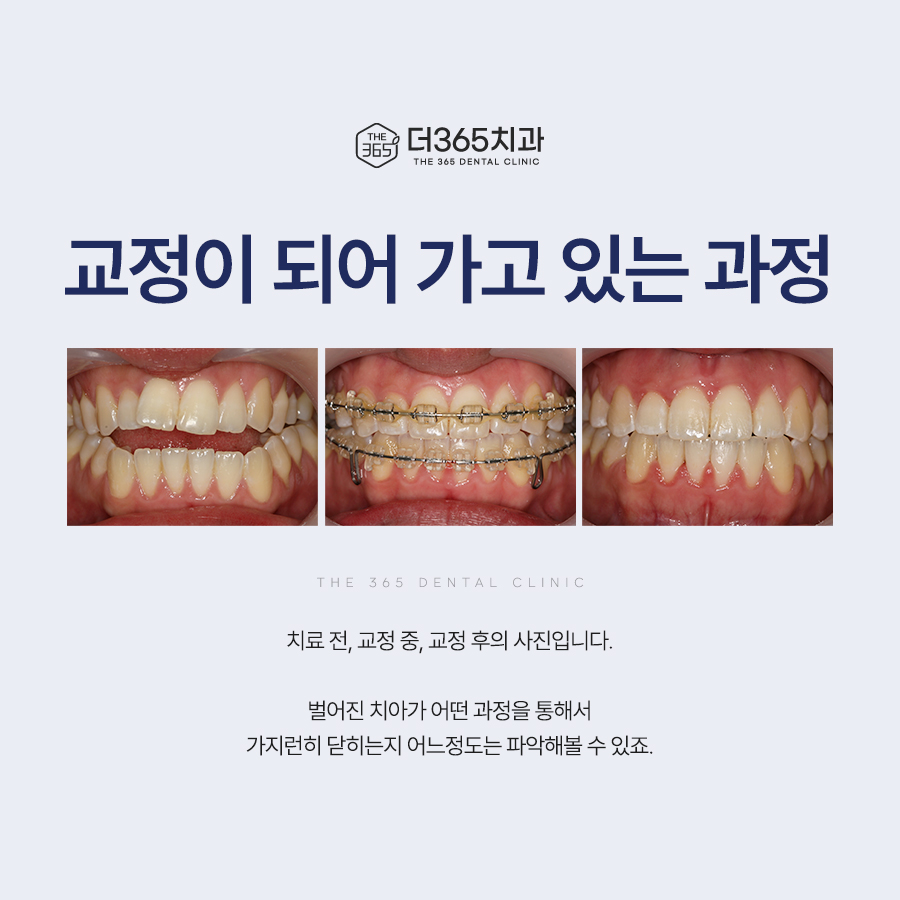 블로그 리뷰